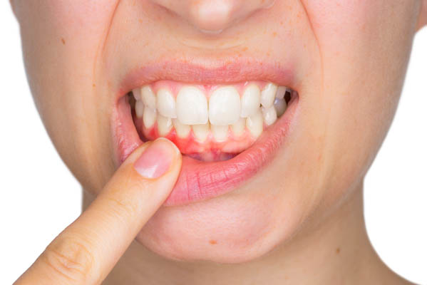 How Gum Disease Is Treated By Your Dentist
