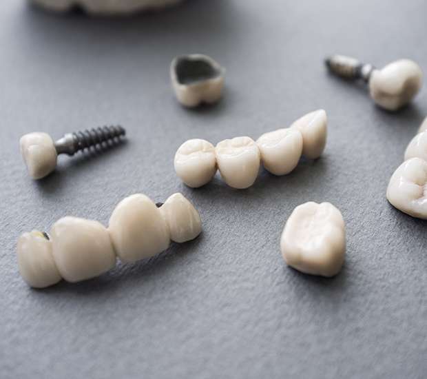 San Dimas The Difference Between Dental Implants and Mini Dental Implants