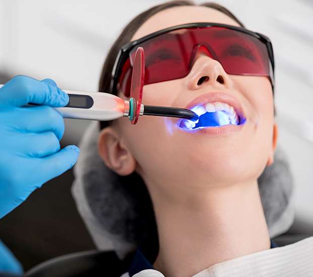 San Dimas Professional Teeth Whitening