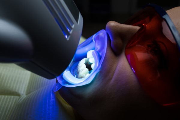 Can A Child Get Teeth Whitening Treatments?